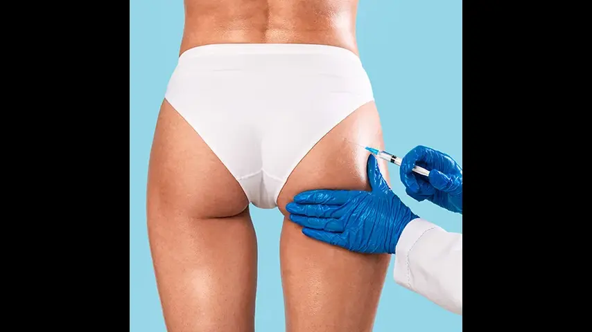 How do I prepare for butt fillers injections in Dubai