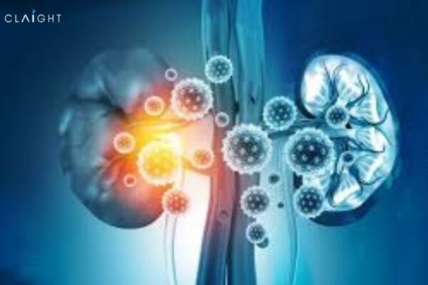 Global Acute Kidney Injury Treatment Market