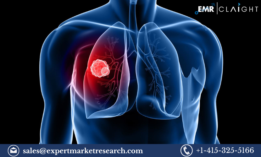 Lung Cancer Screening Marke