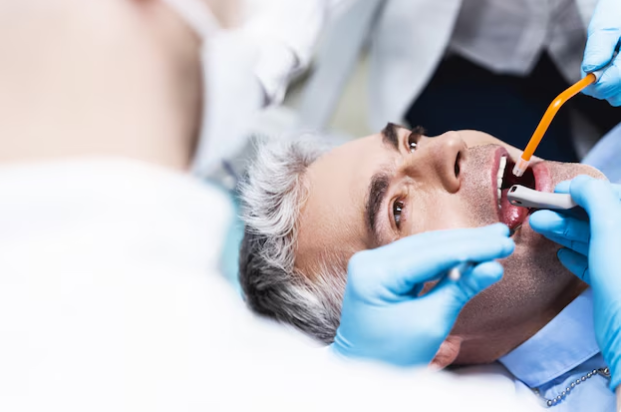 best root canal treatment