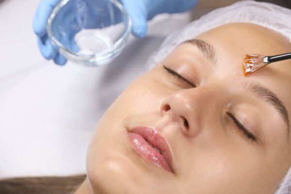 chemical peels in Dubai