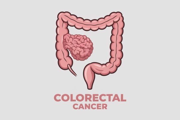 colorectal surgeon in Glendale