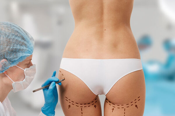 How Fat Transfer Can Enhance Your Look: Insights from the Best Doctors in Dubai