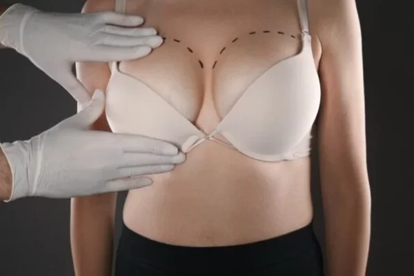 How to Speed Up Recovery After Breast augmentation surgery in dubai