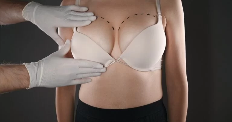 How to Speed Up Recovery After Breast augmentation surgery in dubai