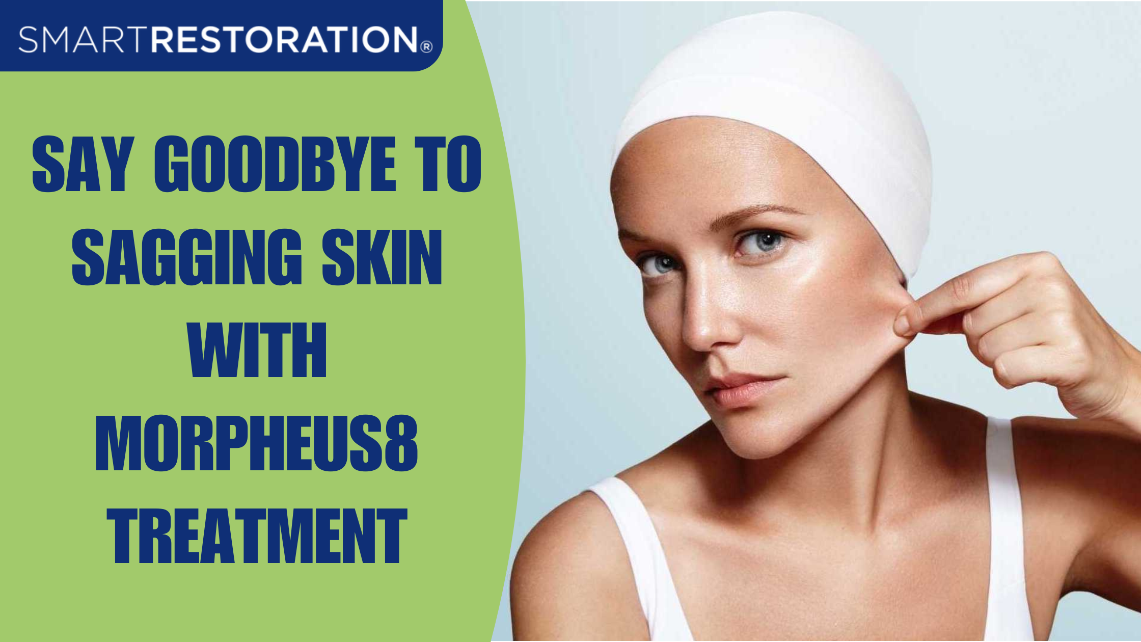 Morpheus8 treatment