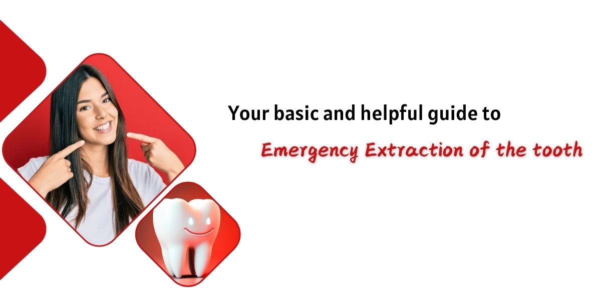 tooth extraction london