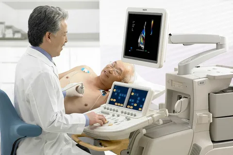 Stress Test Echocardiogram Sydney